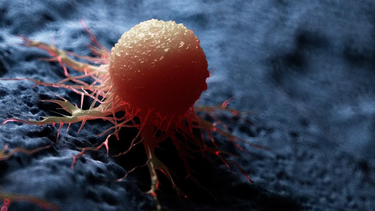 Blood in urine cancer warning sign haematuria Singapore