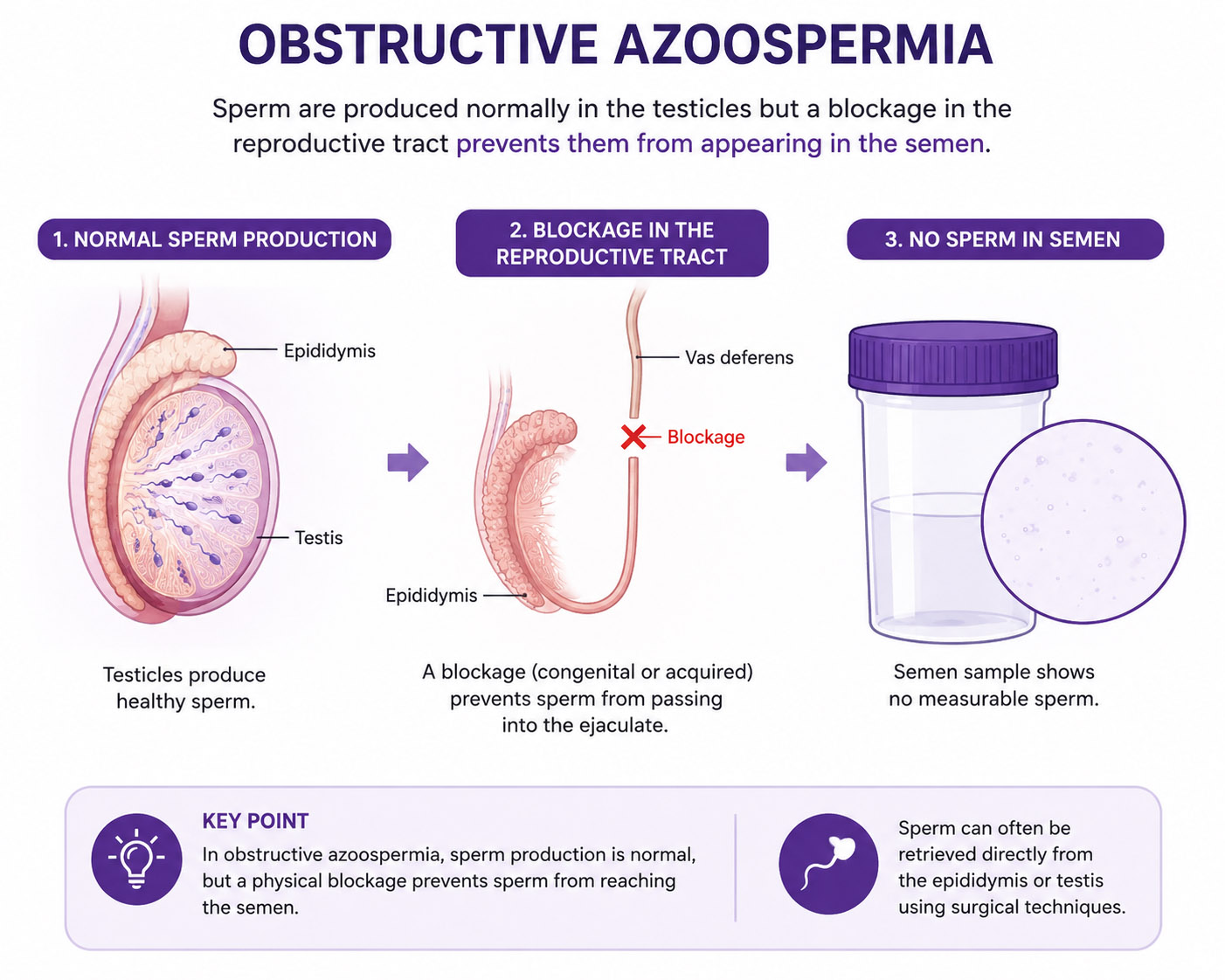 Obstructive Azoospermia Singapore