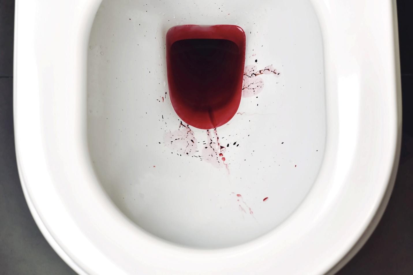 Symptoms of haematuria blood in urine Singapore